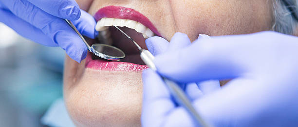 Best Knocked-Out Tooth Emergency  in Washington, GA